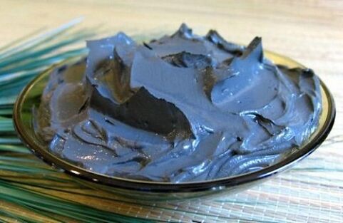 Therapeutic mud is very useful for prostatitis, but it is not indicated for all patients